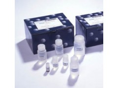 人抗促甲状腺素受体抗体(TRAb) ELISA试剂盒