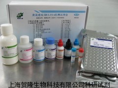 人系统性红斑狼疮(SLE)ELISA试剂盒 进口_生