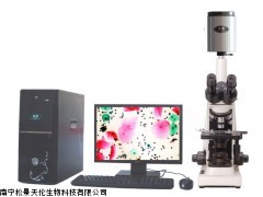 液基细胞分析仪厂家供应，宫颈癌液基细胞分析仪生产厂家