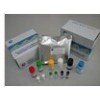 人钙调磷酸酶检测试剂盒