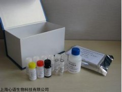 小鼠乙肝病毒抗体(HBVAb)ELISA测定试剂盒,ELISA试剂盒