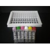 大鼠糖蛋白130(gp130)ELISA试剂盒免运费
