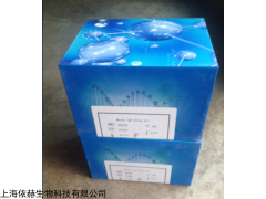 上海人破伤风抗体(Tetanus Ab)ELISA试剂盒价