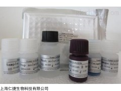人中性粒细胞弹性蛋白酶(NE)ELISA试剂盒科研
