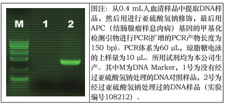 甲基化专一性PCR试剂盒_供应产品_上海信裕